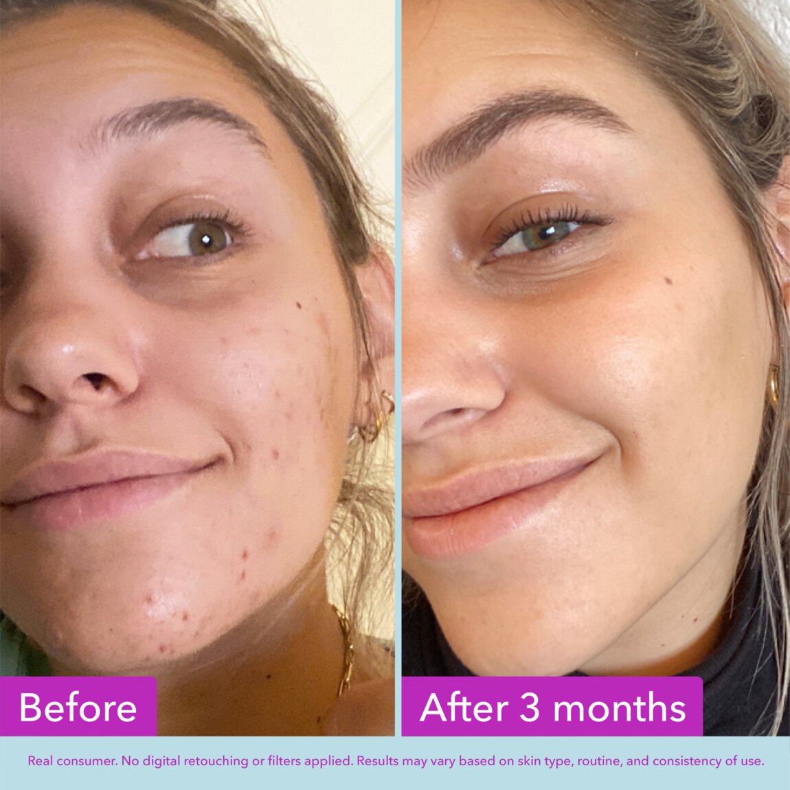 niacinamide-brightening-toner-e8 zb_p.jpg