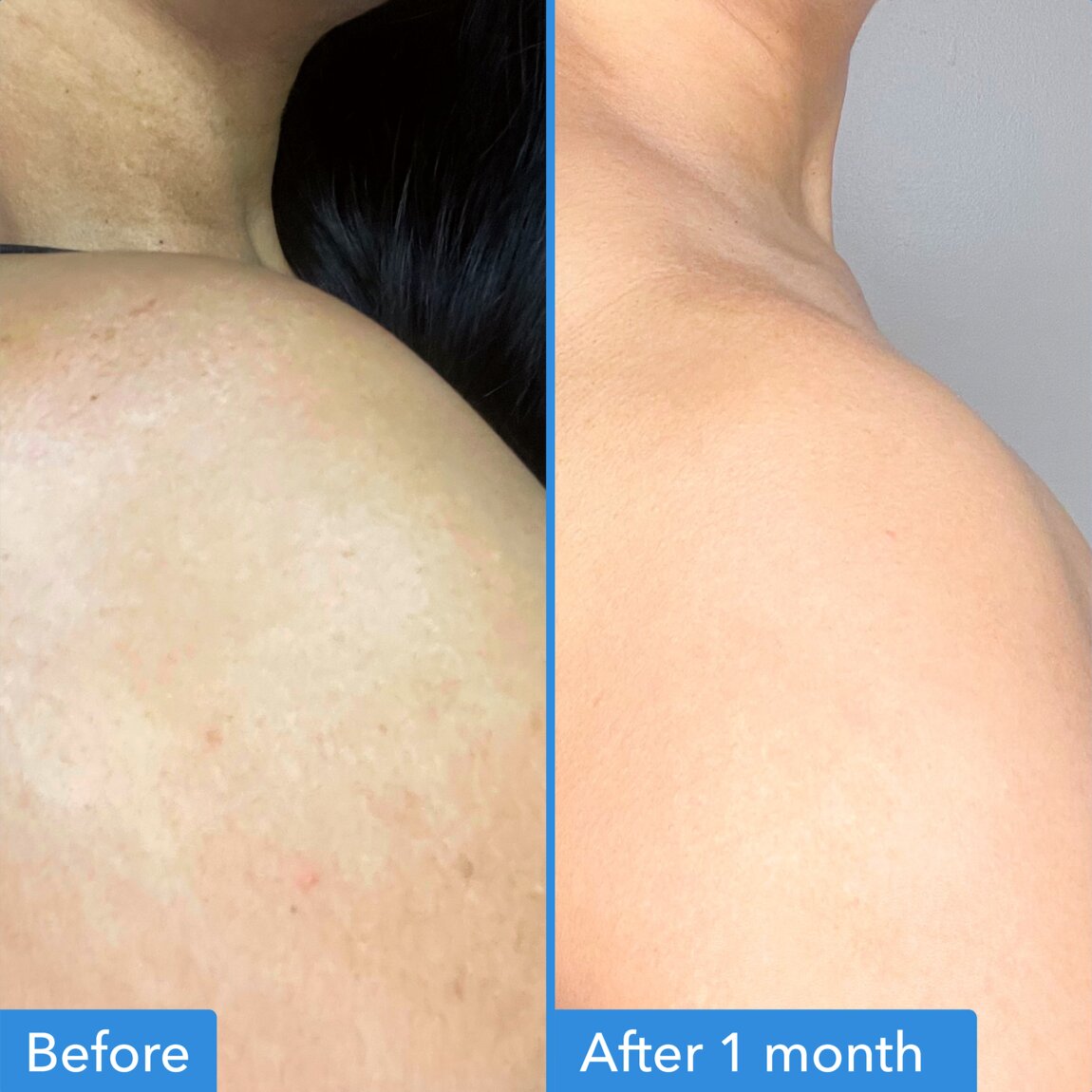 discoloration-correcting-body-treatment-z1 zb_p.jpg