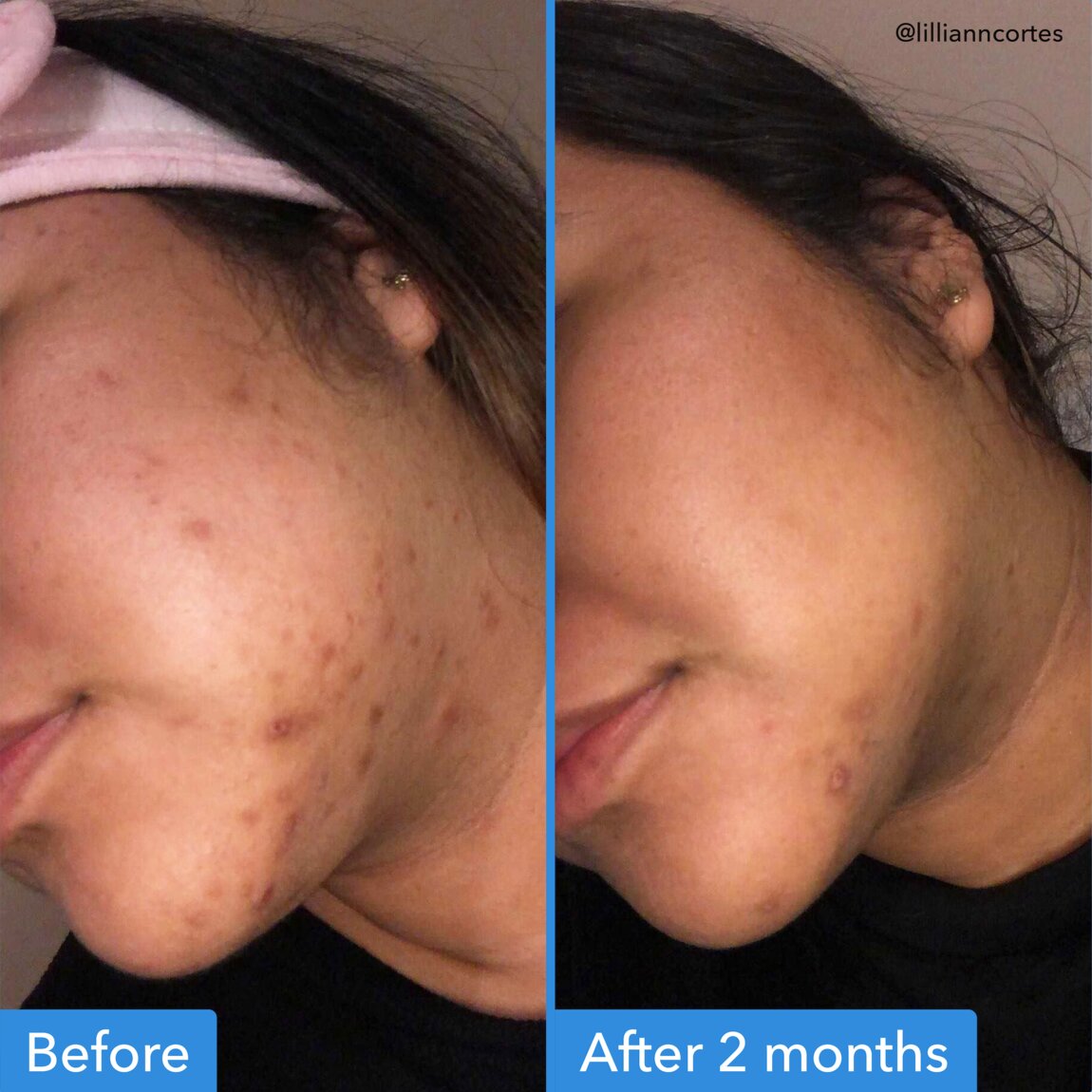 discoloration-correcting-serum-k0 zb_p.jpg